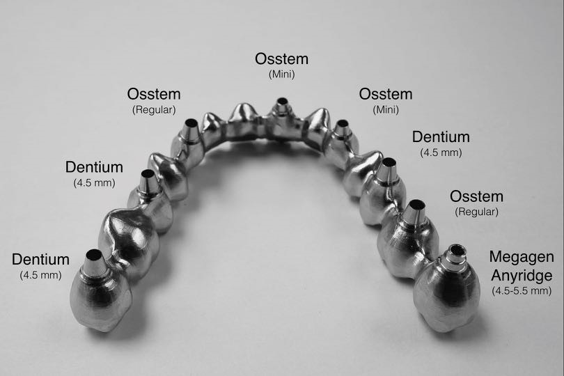 Screw-retained Implant I.jpg